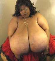 The largest breast belongs to Annie Hawkins-Turner (aka Norma Stitz) (USA) ...